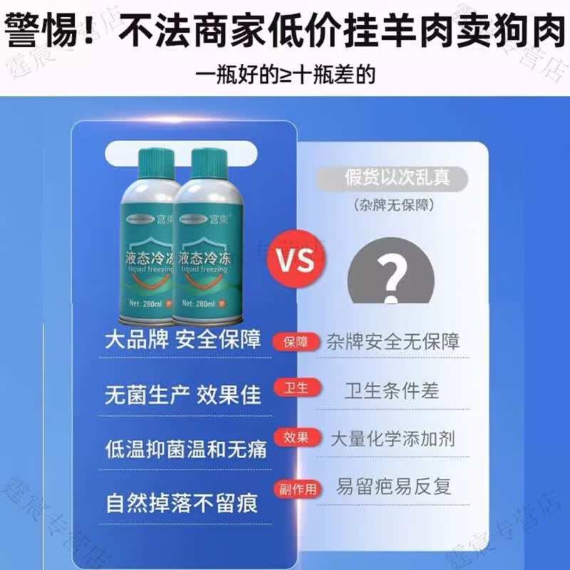 宫束液氮冷冻去疣医用液氮脚跖疣寻常疣鸡眼物理疣小肉粒疙瘩液态冷冻 液态冷冻700赠配件 正品保证 京质保障