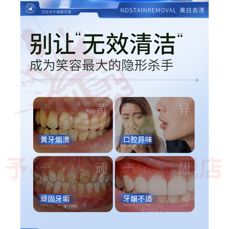 鹿角卉常天天然沁爽美白牙膏去渍牙垢结石去黄去口臭改善口臭口腔护理牙 五支装 【全家呵护】 官方自售