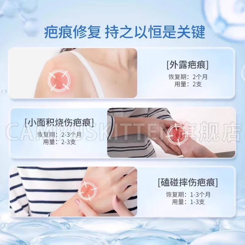 芭乐祛疤凝胶祛疤膏专用特效膏药修复新旧疤痕增生凸起烧伤烫伤剖 五盒巩固装【磕碰摔伤疤痕】买三贈二 【正品直售 京质保障】