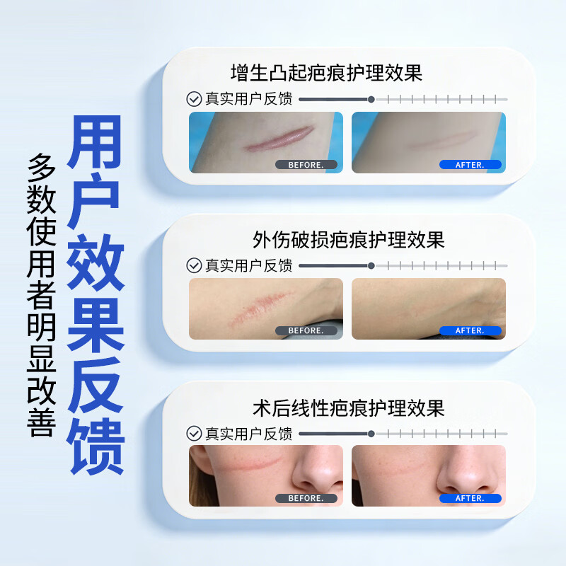 AICOMEGO医用疤痕凝胶祛疤膏修复病理性疤痕生长淡化因子xf 20g/支 医用祛疤凝胶1支*20g