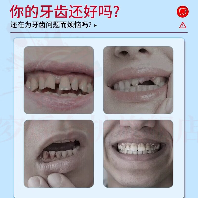 思亚希萌大夫釉言康脱敏牙膏牙齿怕冷酸痛抗敏感脱敏刷牙无氟牙科分离剂 5支装【长效护龈再生】 官方自售