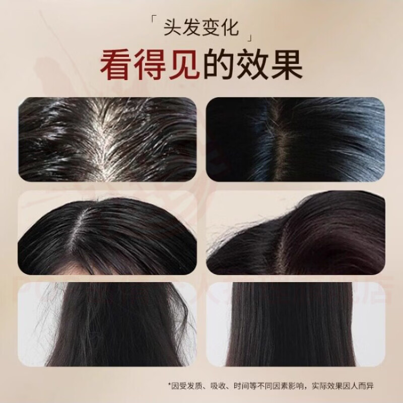 岳倩纪羽颜防脱洗发水记羽言增密滋养发根焕活毛囊控油蓬松去屑止痒
5瓶装【严重脱发+巩固装浓密发缝】 官方自售