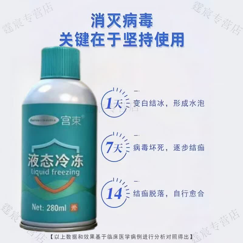 宫束液氮冷冻去疣医用液氮脚跖疣寻常疣鸡眼物理疣小肉粒疙瘩液态冷冻 液态冷冻700赠配件 正品保证 京质保障