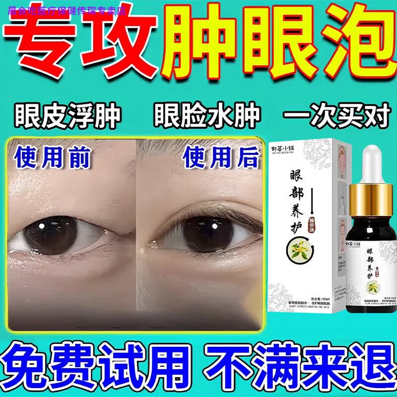 晨会吃家庭护理肿眼泡去脂消肿消除眼睛眼部脂肪厚眼皮松弛眼皮浮肿神器 单盒装