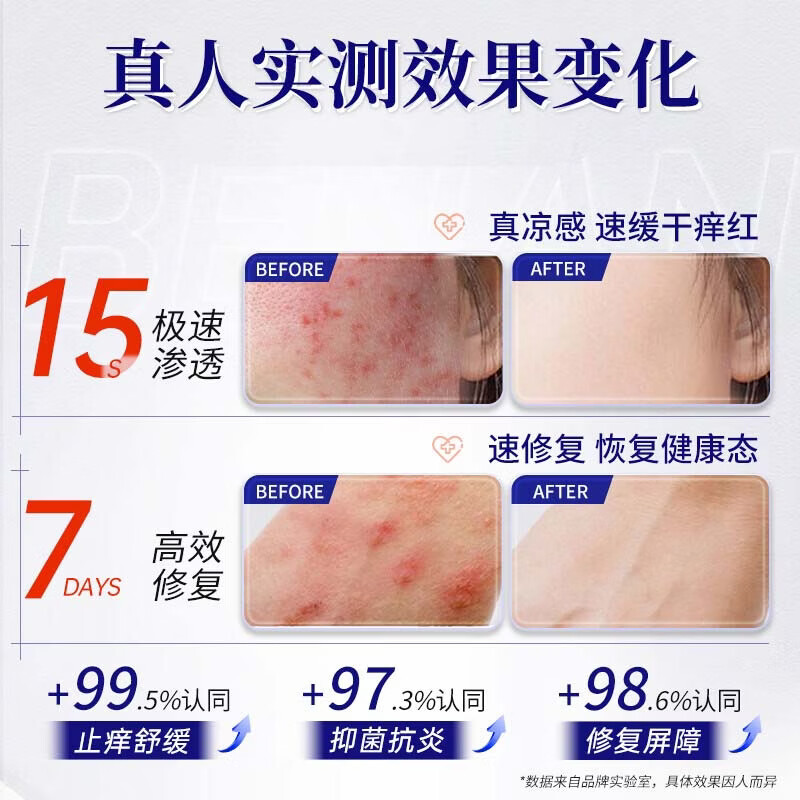 山顶红紫花椒透皮膏皮肤瘙痒止痒紫花地丁膏透皮皮肤止痒 山顶红肤痒宁【肤痒清】20g*1瓶装 网红爆品