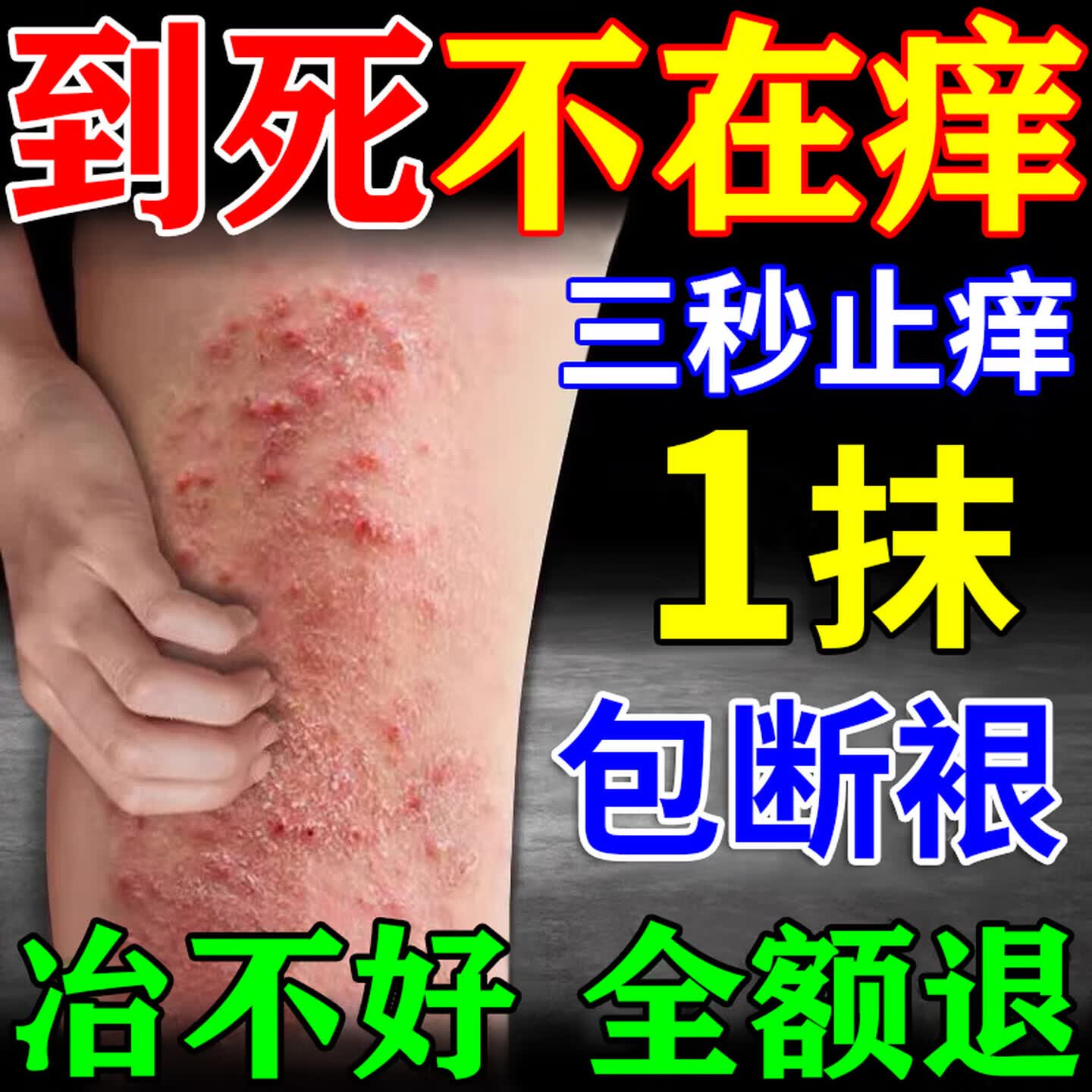 【3秒止痒】炉甘石皮肤干燥皮炎湿疹止痒润肤乳抑菌皮肤瘙痒膏 1瓶【3秒止痒】不管用不要钱 皮肤干燥瘙痒止痒效果最好的药