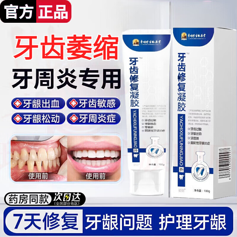 思亚希俊小白牙龈i萎缩护理牙膏羟基磷灰石修护牙齿出血松动周炎脱敏剂 1支装【见效装】 官方自售 京东折扣/优惠券