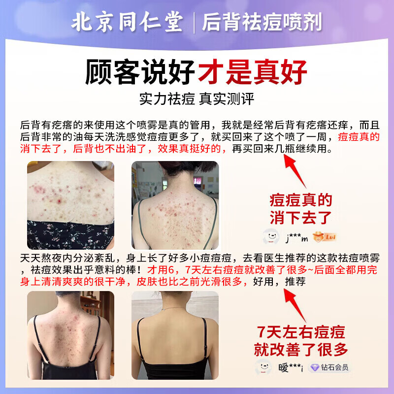 东田后背痘痘药膏后背长痘痘毛囊炎专用前胸后背部脓包痤疮 一盒装【多买多送】发货特效快 祛痘喷雾剂