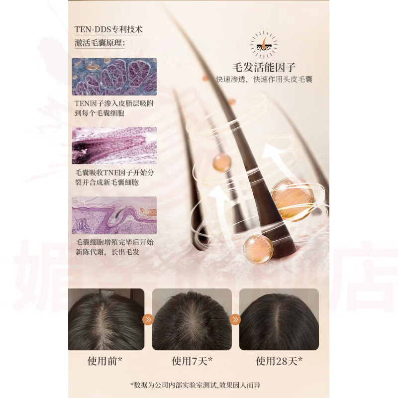 媚癸曲蔻丝影植物防脱洗发水何首乌萃取防断育发固发强韧发根滋养控油 1瓶周期装【防脱养发】 官方自售