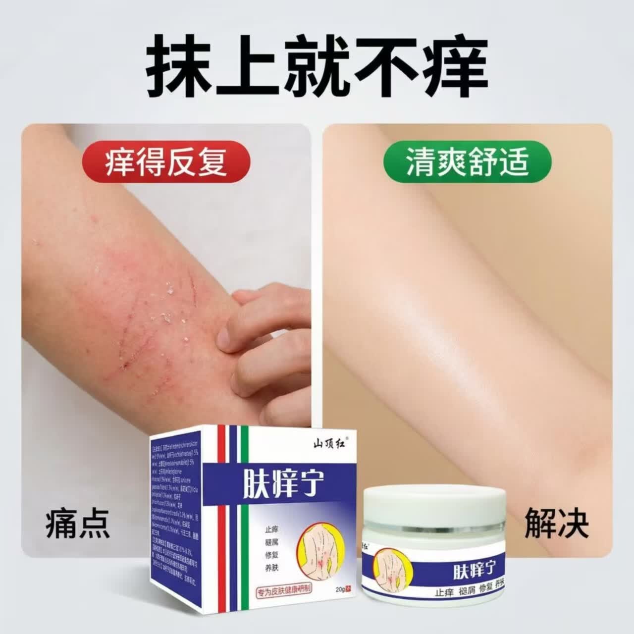 山顶红紫花椒透皮膏皮肤瘙痒止痒紫花地丁膏透皮皮肤止痒 山顶红肤痒宁【肤痒清】20g*1瓶装 网红爆品