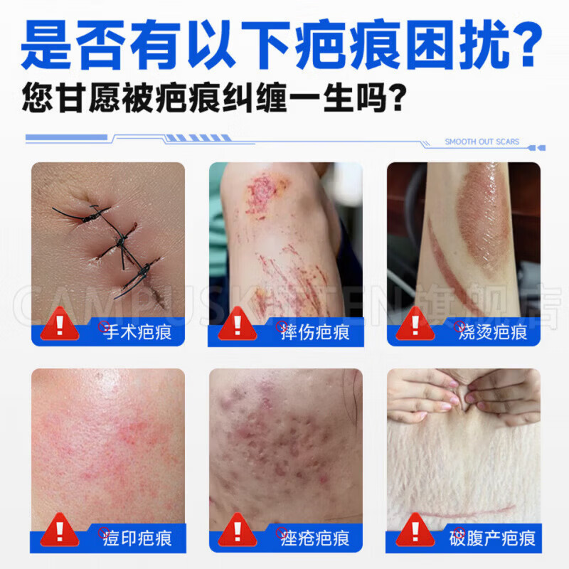 芭乐祛疤凝胶祛疤膏专用特效膏药修复新旧疤痕增生凸起烧伤烫伤剖 五盒巩固装【磕碰摔伤疤痕】买三贈二 【正品直售 京质保障】