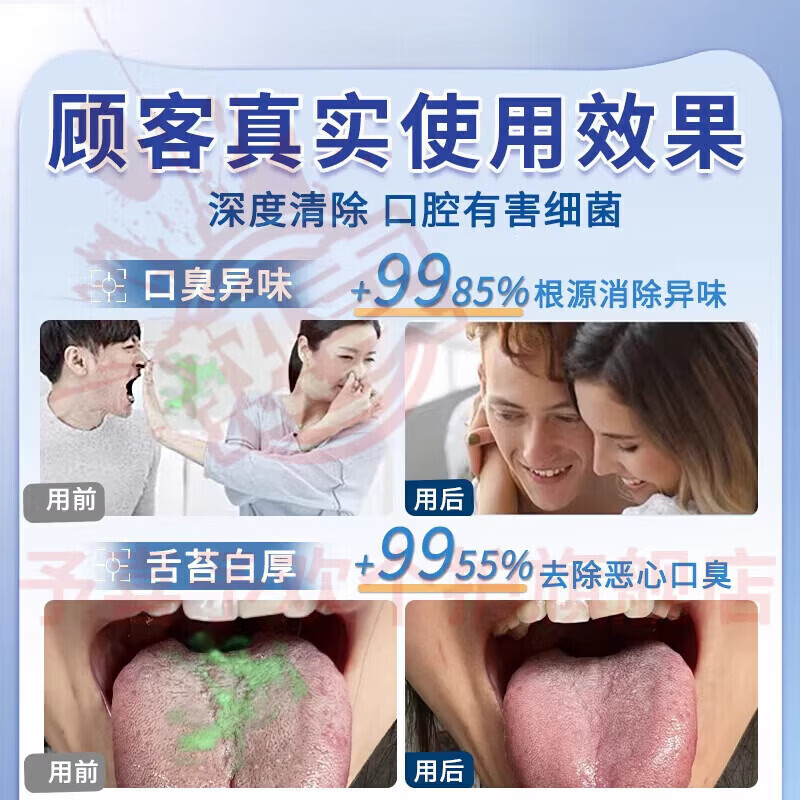 鹿角卉安贝歌去口臭牙膏本草口腔清新口气异味去渍结石牙垢固齿护龈 五支装 【全家呵护】 官方自售