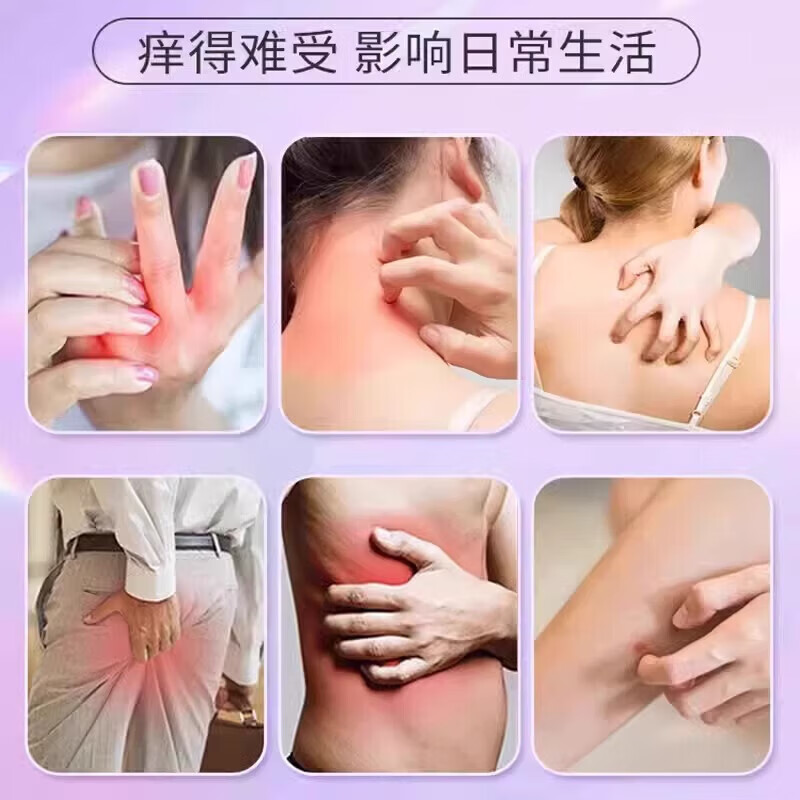 同仁堂紫花地丁透皮抑菌膏皮肤瘙痒湿红疹止痒婴幼儿成人软膏  3盒装【周期转】店长推荐