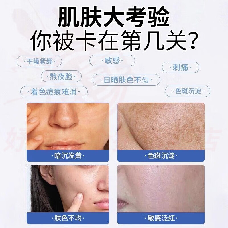 熏姿颜朵佑淡化黄褐斑凝胶烟酰胺凝胶医用美肤白原液祛斑霜去黄械字号 1支【见效装】 官方自售