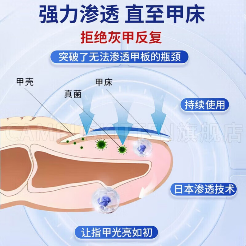 BEIYVS郑远元灰指甲抑菌液【官方旗舰正品】搽剂杀菌脱甲膏 5瓶【巩固完善囤货装】 【官方直售】