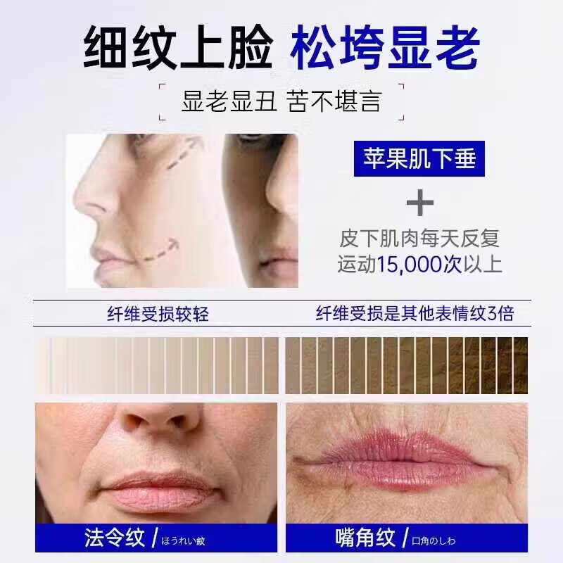 MRYU舒活宜凝胶祛法令纹颈纹医用硅酮凝胶提拉修护紧致肌肤官方旗舰店 3支装 官方自售