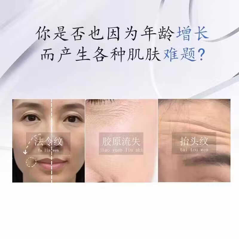 MRYU舒活宜凝胶祛法令纹颈纹医用硅酮凝胶提拉修护紧致肌肤官方旗舰店 3支装 官方自售