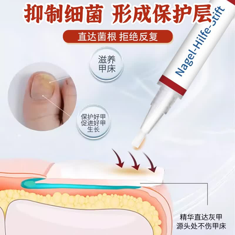 L0【德国进口】灰指甲笔抑菌液去灰指甲甲增厚专用修复指甲护理正品 【重度疗程】灰指甲笔*3