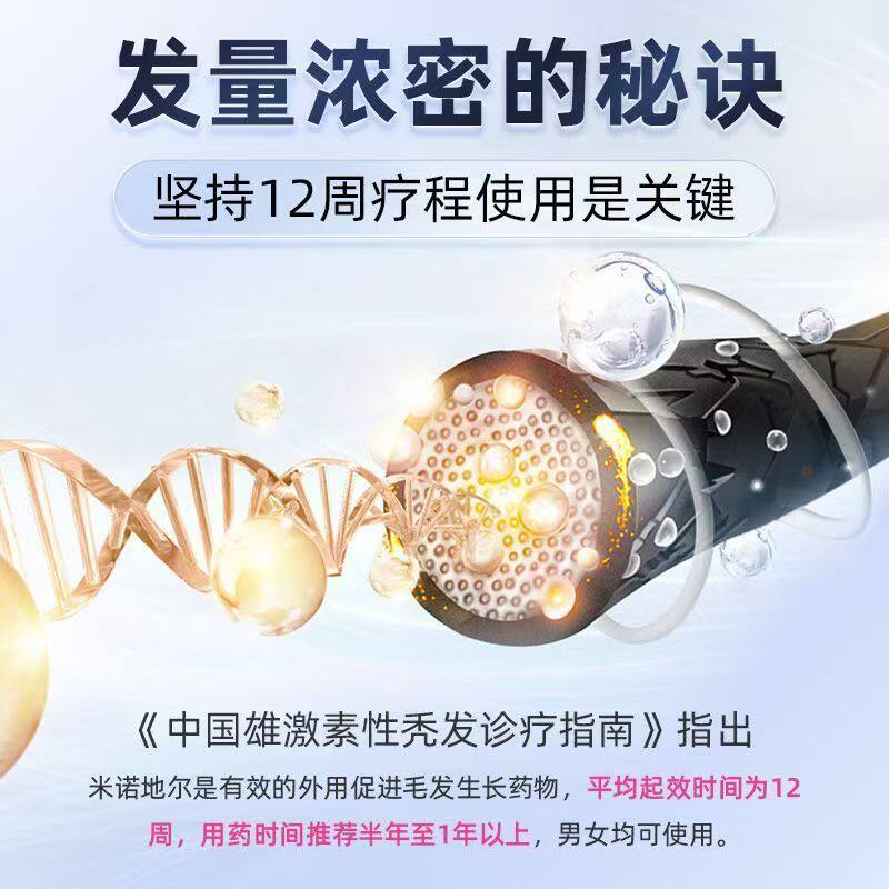 [威郎中]米诺地尔搽剂 5%*60ml 1盒装 男女士专用防治脱发密发增发生发液剂酊激活毛囊斑秃掉发国药准字发际线生发液3g 1个月用量 官方正品