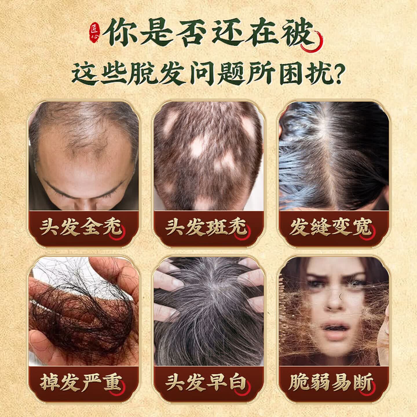 [仁和]固肾生发丸 2.5g*27袋 3盒装 正品 国药准字大药房 斑秃 全秃 普秃及肝肾虚引起的脱发 男女脱发 脱发严重男女专用药