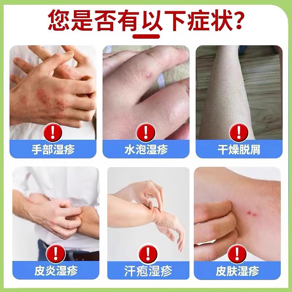 修正干燥起皮凝胶口周皮炎软膏医用皮肤修复湿疹药膏皮炎修复凝膏 1支