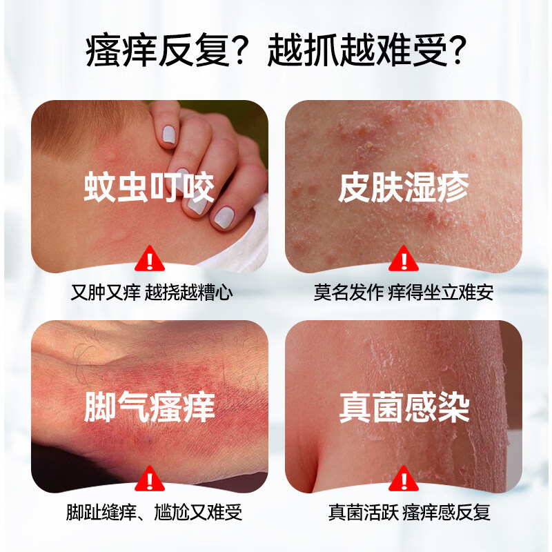 LAPOR断痒王皮肤瘙痒干痒止痒软膏全身痒温和抑菌B 20g 全身止痒断痒王20g