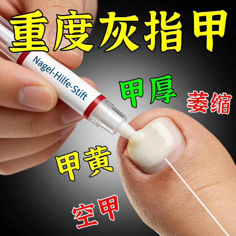 L0【德国进口】灰指甲笔抑菌液去灰指甲甲增厚专用修复指甲护理正品 【重度疗程】灰指甲笔*3.