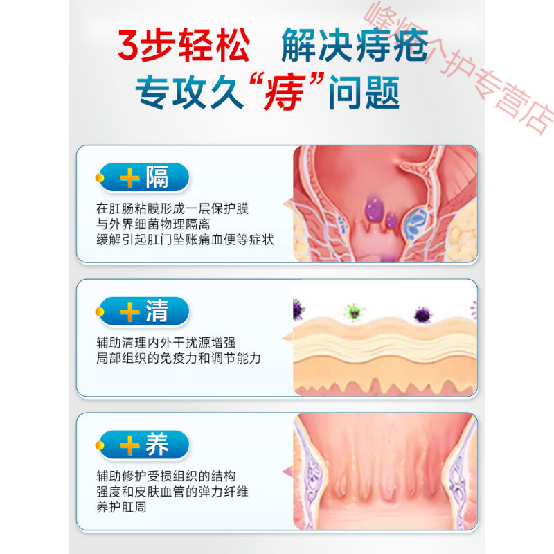 熏姿颜比尔小蓝痔疮凝胶医用壳聚糖肉球瘙痒混合痔肛门坠粘膜充血睡眠贴 1盒装【见效装】 官方自售