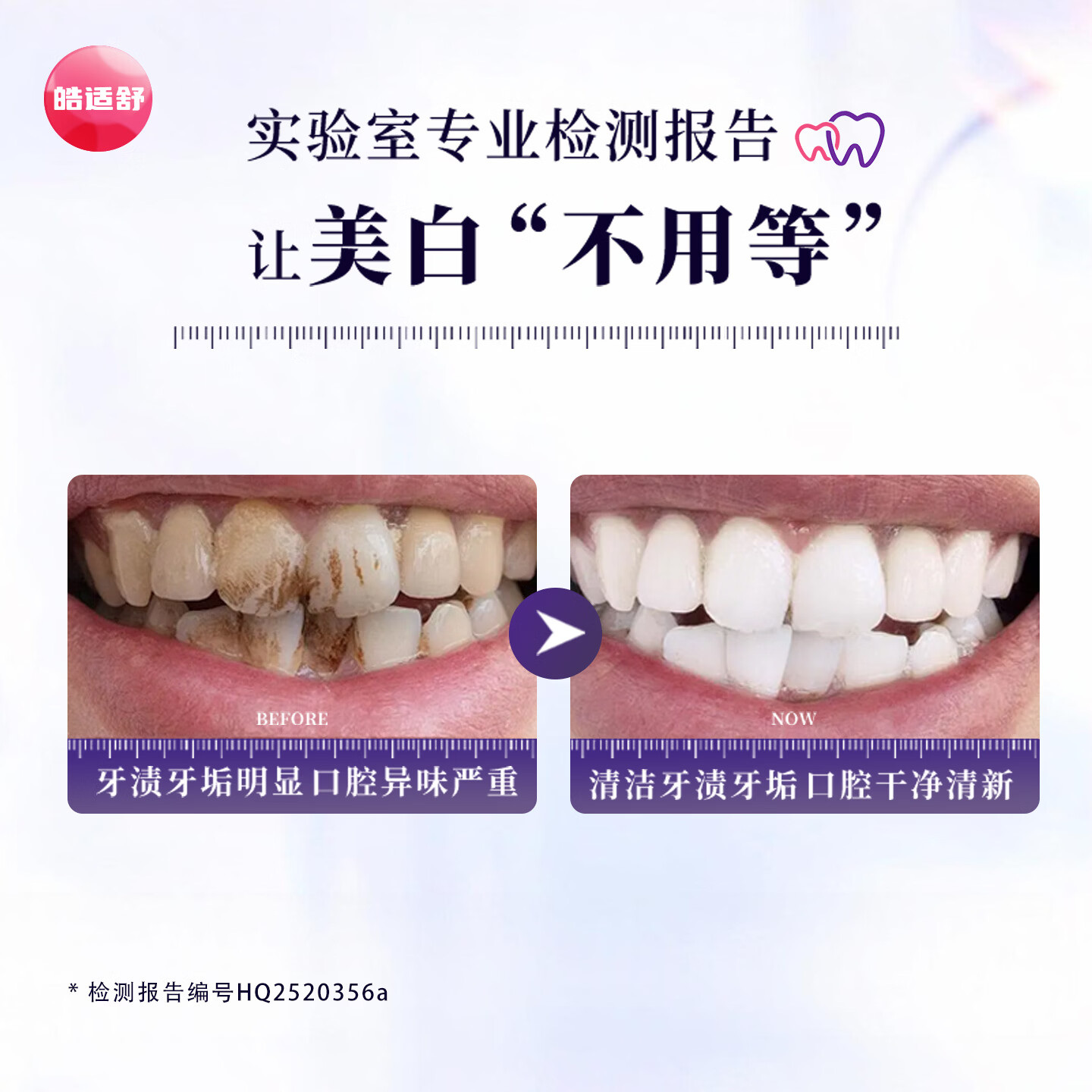 皓适舒6支装50g美白牙膏去黄去渍去口臭去牙渍去烟渍牙垢7天白3倍 【超值囤货】美白牙膏6支