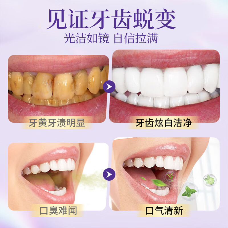 YUHOO美牙酶紫光亮齿色修牙膏亮白牙齿去黄渍去牙垢口气清新护牙慕斯 紫光亮齿色修牙膏50g*2支