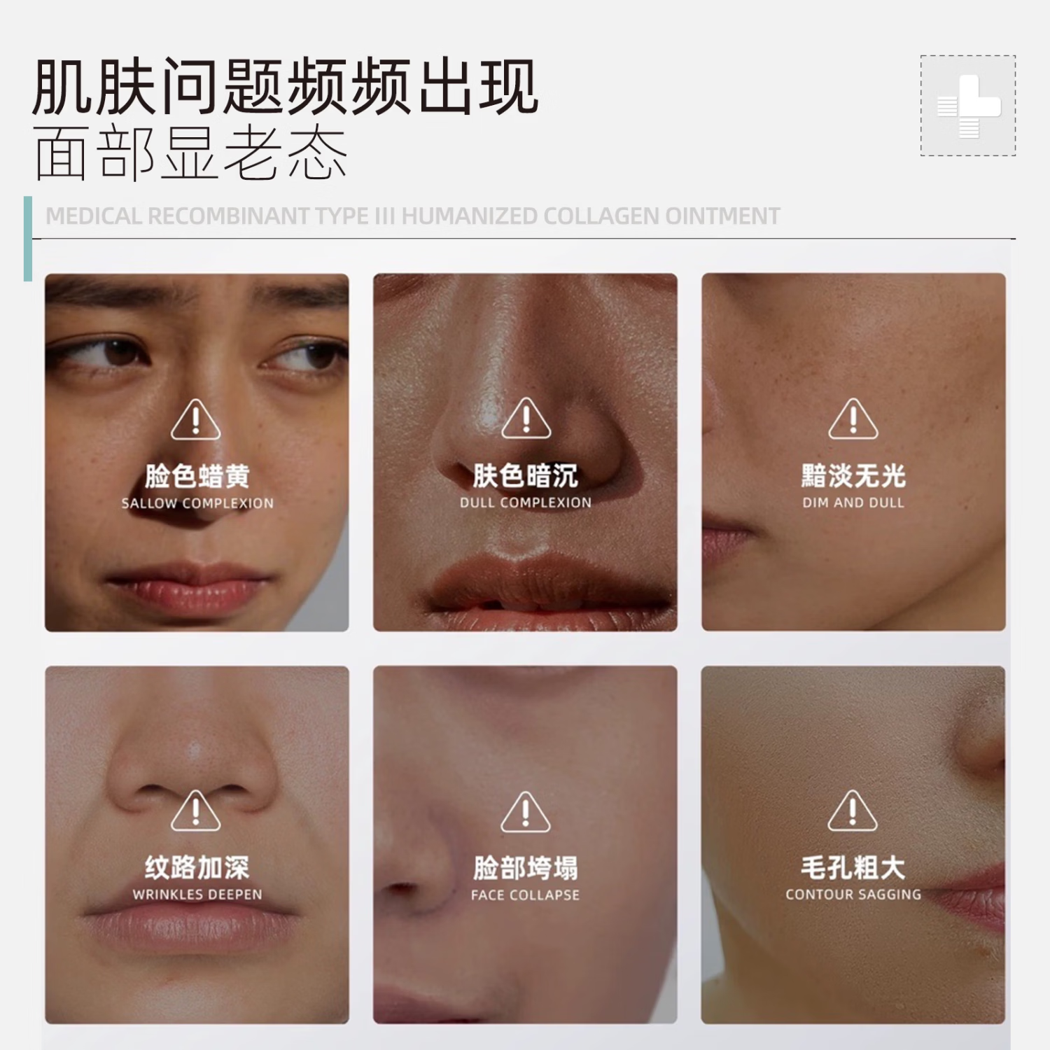 ZHUOCONA 卓康纳胶原霜zoa胶原敷料卓康纳蛋白霜zoa医用重组胶原蛋白敷料面霜 一盒体验装【多买更划算】