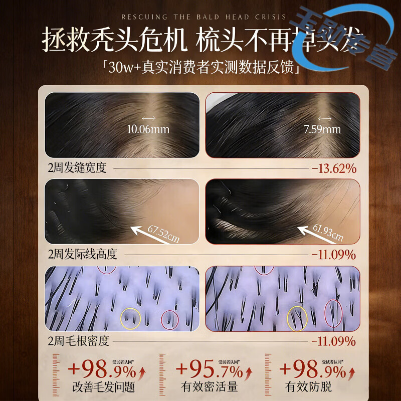北欧青舍 NORDIC HOUSE柚可言洗发水草本人参滋养控油去屑止痒韧发防断发丝强健专营正品 1瓶【轻度掉发 权威认证】 【正品直售 京质保障】