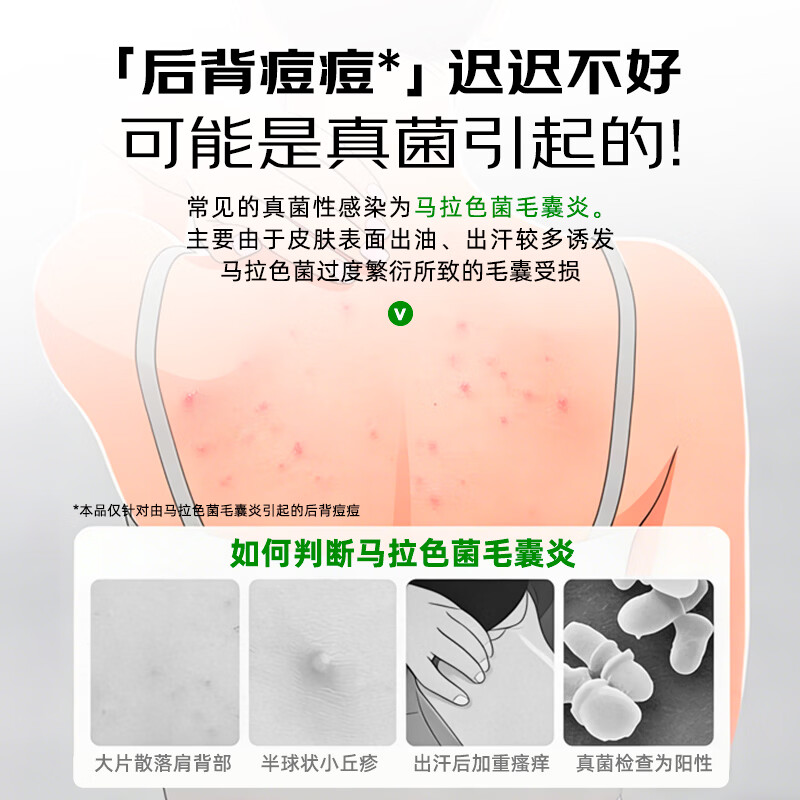 [九芝堂]硝酸咪康唑乳膏 17g 2盒装 官方正品真菌药膏脚气抗真菌止痒感染药真手足癣体股癣念珠菌病抗菌软膏