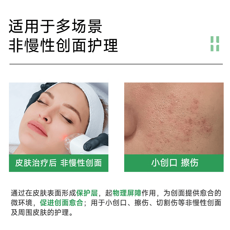 自然攻略医用重组III型人源化胶原蛋白修复敷料喷雾小白喷 50ml*2【到手2瓶装】