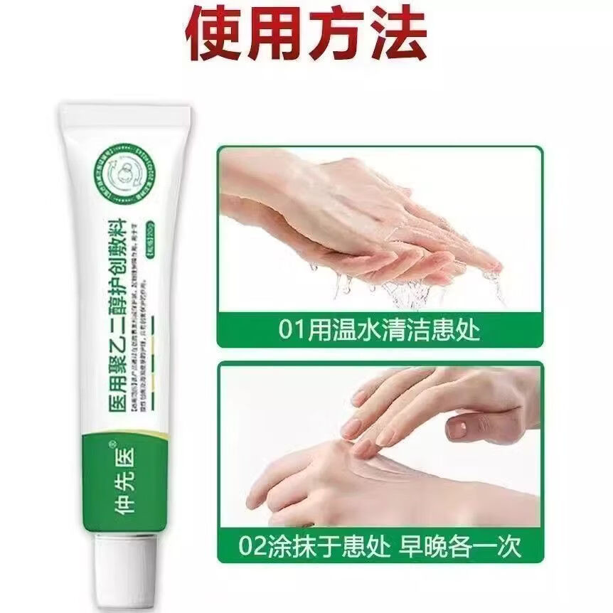 仲先医医用聚乙二醇护创敷料止痒膏老幼孕都可用皮肤私处等过敏瘙痒 5盒【家庭备药装】划21.8/盒