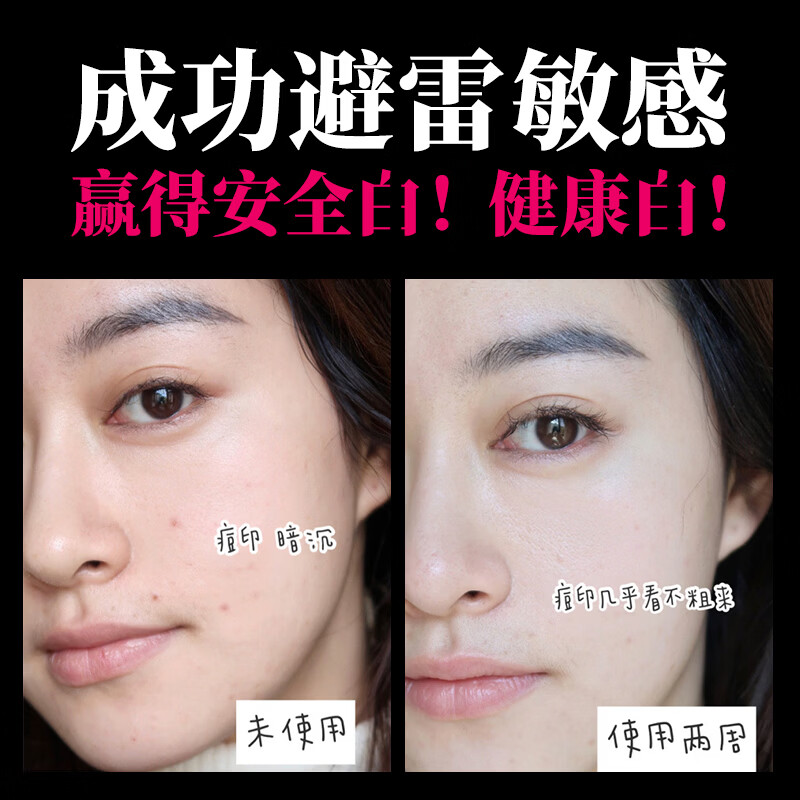 小野拓司2代升级我要铂面膜 15分钟闪白 超越水光biu 提亮减黄K衰修护 1盒·上新体验:288元/盒 立省250元