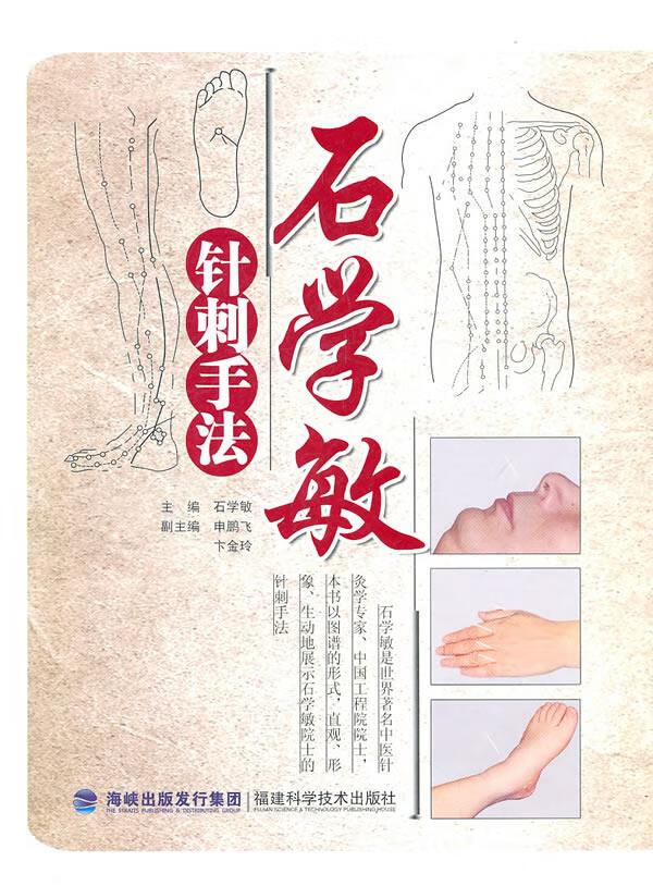 石学敏针刺手法