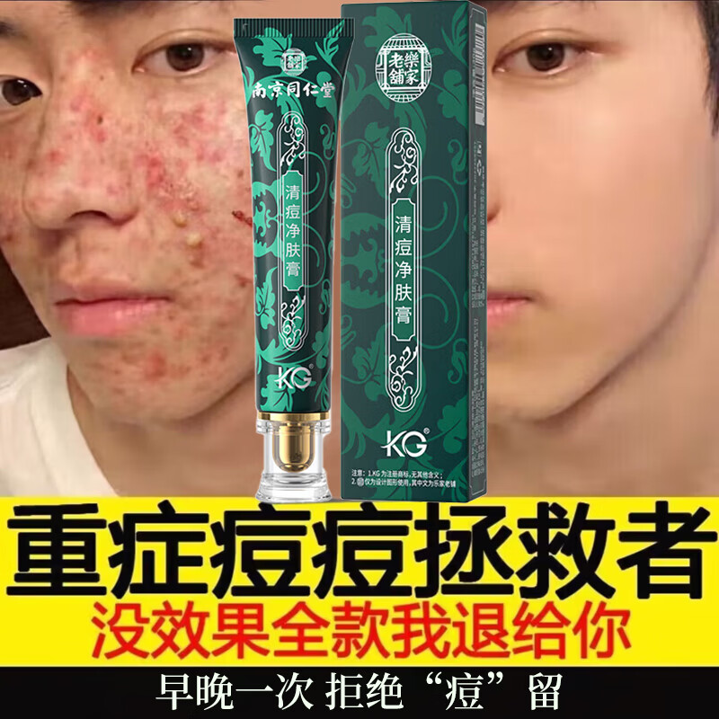 同仁堂祛痘膏去痘痘和痘印痘坑修复男女士改善粉刺闭口30g