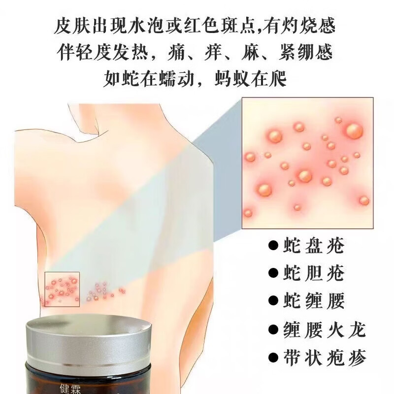 健霖蛇胆灵 带状疱疹专用 医用级皮肤修复 蛇缠腰神经痛护理 买二送一(每瓶划118元)