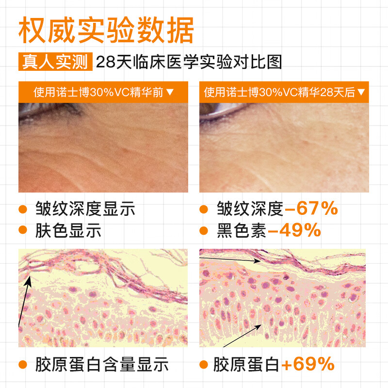 诺士博（NOVEXPERT）法国进口30%VC精华液秋冬养白去黄提亮维c原液孕妇护肤品礼物10ml 【秋冬升级亮肤】30%VC精华10ml