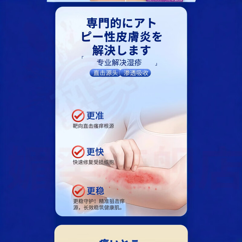 媚癸苗盟妙奈花湿疹膏湿珍疹皮肤止痒皮肤瘙痒去顽固湿毒神经性 1瓶【见效装】 官方自售