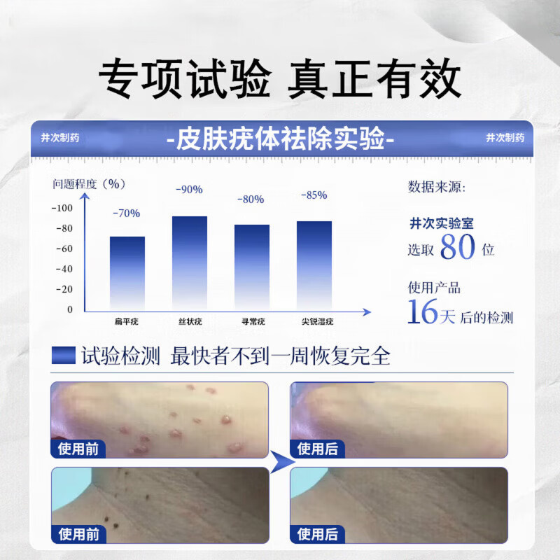 鹤古安尤肤平保健液干扰素凝胶去疣药丝状疣一抹灵扁平疣去除喷剂 3瓶【周期改善装疣疾无忧】买二赠一 【官方直售】