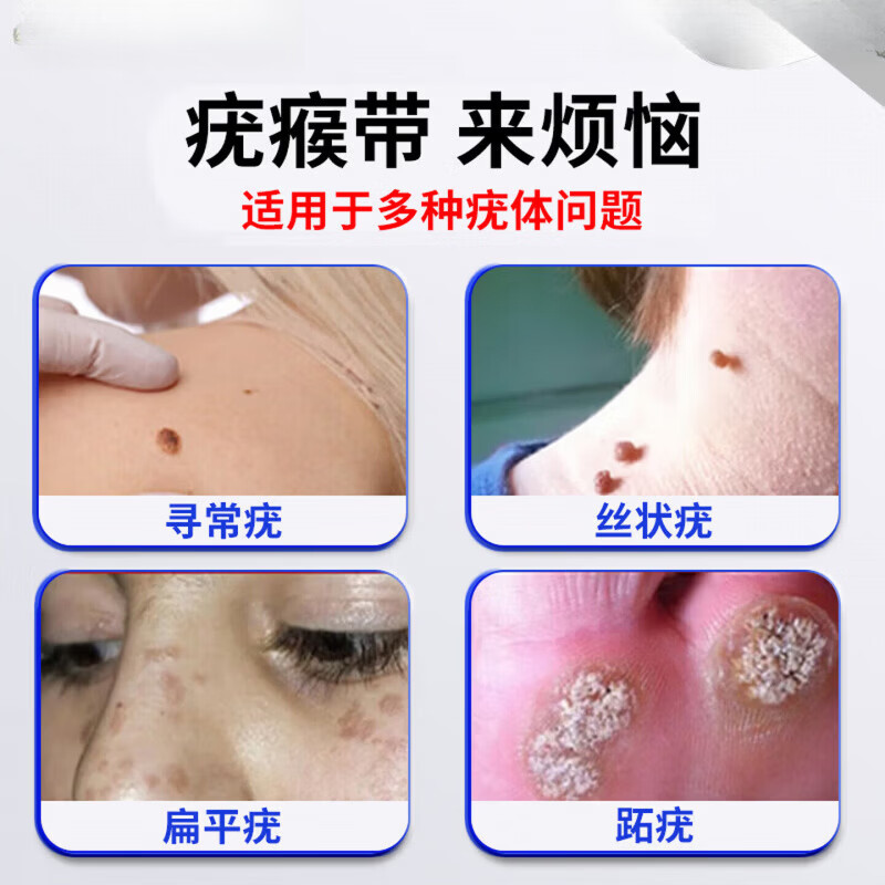 鹤古安尤肤平保健液干扰素凝胶去疣药丝状疣一抹灵扁平疣去除喷剂 3瓶【周期改善装疣疾无忧】买二赠一 【官方直售】