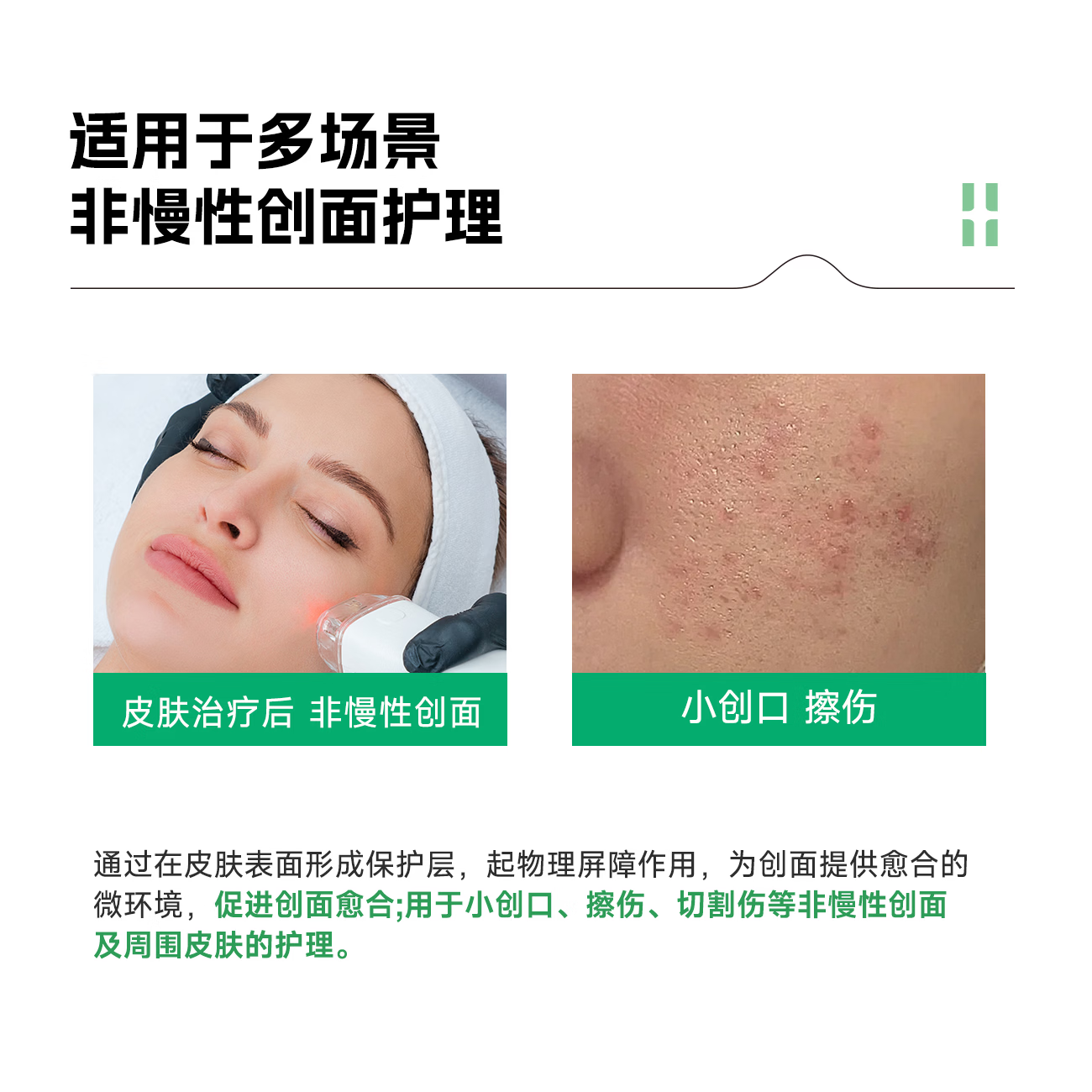 自然攻略医用重组三型人源化胶原蛋白敷料次抛精华液术后护理 15支装【赠送绿膜一片】