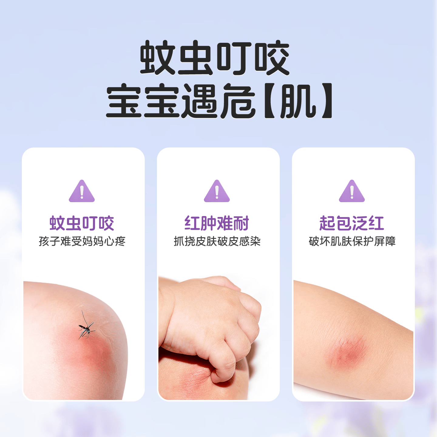 Akasugu多效舒润紫草膏儿童宝宝户外叮咬多效修护防蚊止痒 【两支装】6g*2