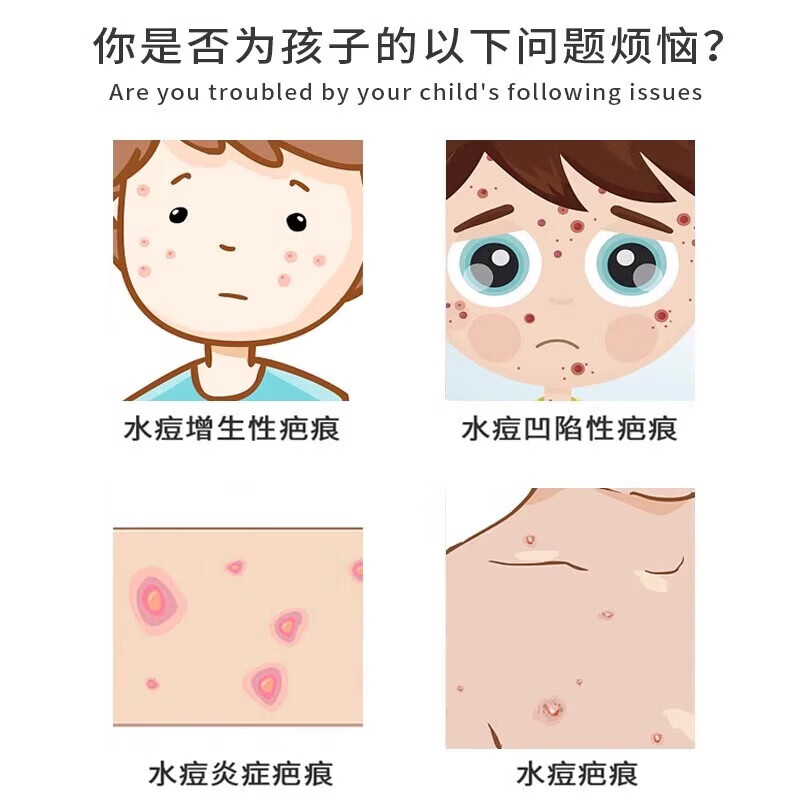 修正水痘疤痕修复凝胶水痘坑痘印复凹洞搭配生长因子祛陷疤膏儿童成人 单盒【体验装】