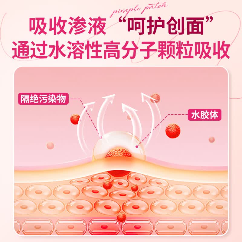 大卫水胶体创可贴无菌敷贴痘痘贴星星爱心青春痘轻薄遮瑕隐形人工皮 粉色40贴