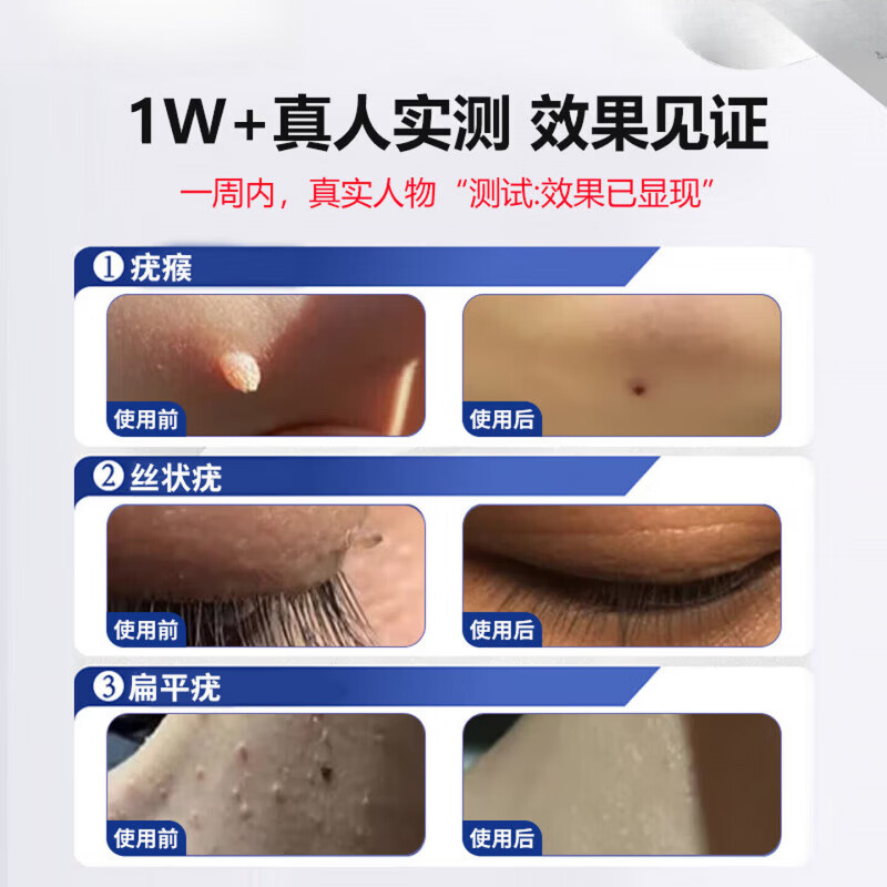 鹤古安尤肤平保健液干扰素凝胶去疣药丝状疣一抹灵扁平疣去除喷剂 3瓶【周期改善装疣疾无忧】买二赠一 【官方直售】