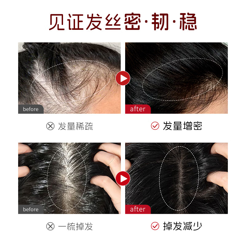 UROSE店出防脱固发洗发水控油去屑蓬松男女非侧柏叶何首乌洗头发膏液露 【2瓶】防脱固发洗发乳400ml