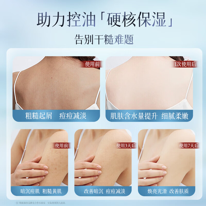 维特丝洗发水膏去屑止痒控油柔顺蓬松男女士留香72小时控油保湿沐浴露 紫色套装-洗发水+沐浴露（共1.6kg）